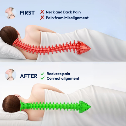 Cervalign™ – Ergonomic Cervical Relief Pillow